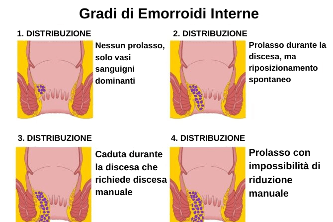4evre-Blog-Fotosu