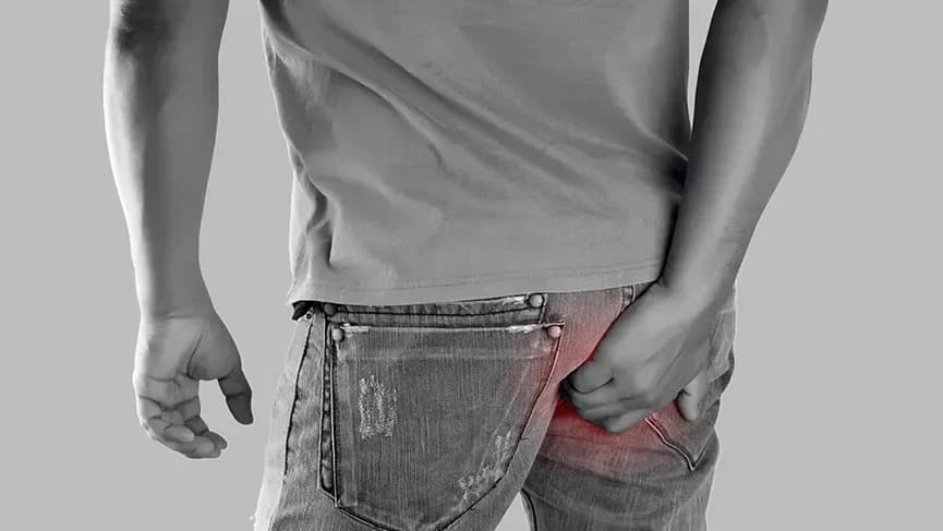 anal-fissure-causes-symptoms-tre