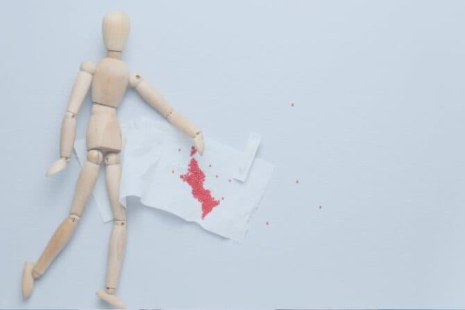anal-fistul--670x446