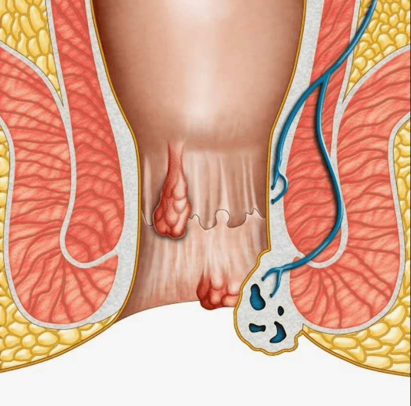 anus-estetigi