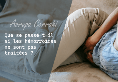 hémorroïdes