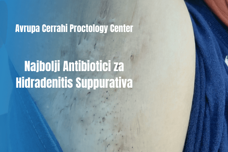hs-antibiyotik-serbia-blog