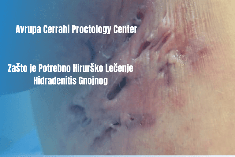 hs-req-surgical-rs-blog
