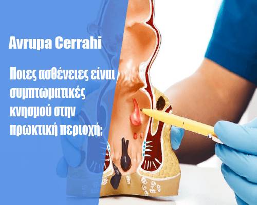maketli-banner-aya
