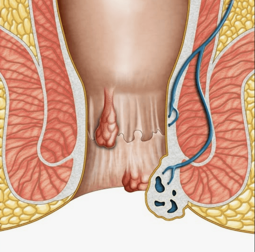 anus-estetigi