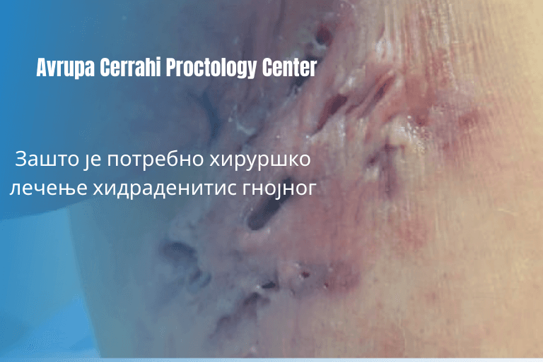 hs-req-surgical-serbia-blog