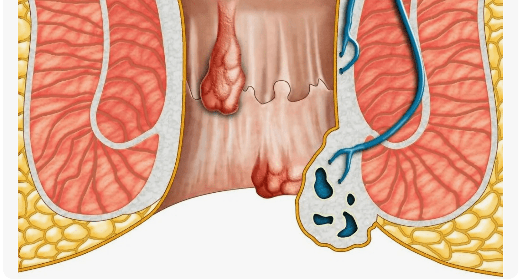 Anal aesthetics treatment price illustration