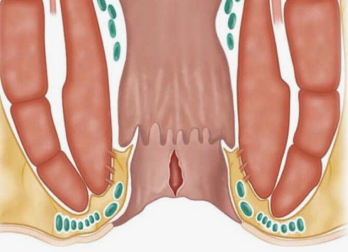 Qadimgi qandoqning surati