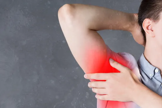 Hidradenitis Suppurativa