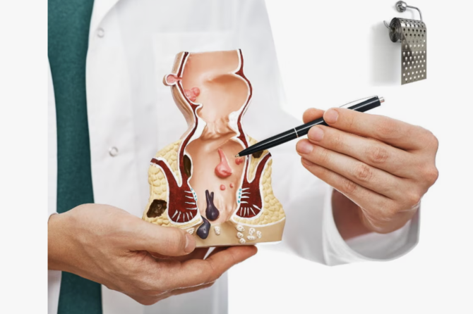 Si bëhet ekzaminimi i parë për hemorroidet?