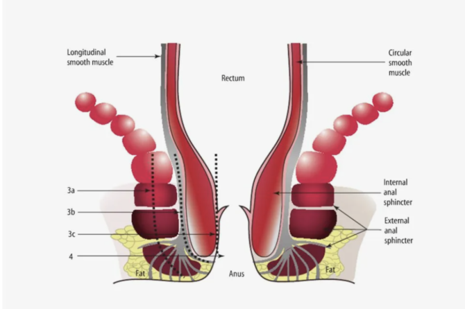 5 Simptomat e Hemorroideve dhe Çfarë Duhet të Bëni