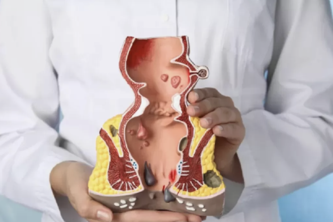 Sëmundjet e Anusit Gjatë Shtatzënisë dhe Pas Lindjes