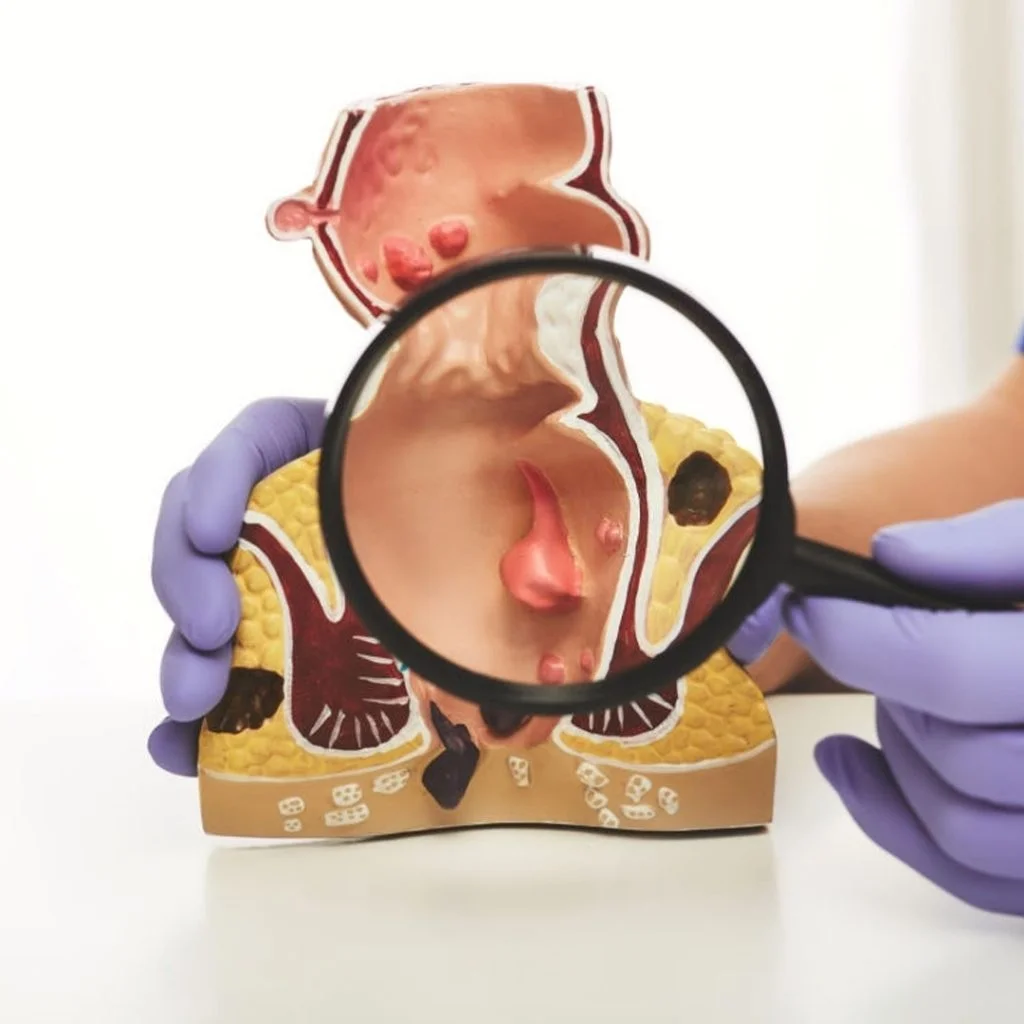 Ular aroq uchun sorishadi Yumshoq opish va jinsiy aloqa