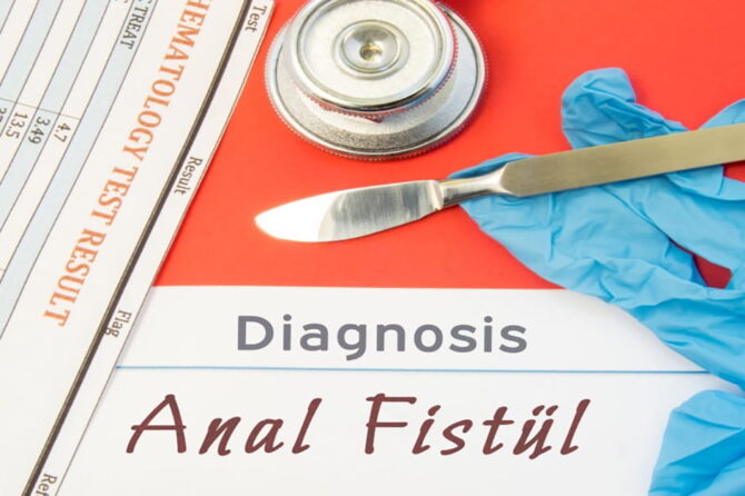 Anal fistula öz-özünə yox olurmu? Necə müalicə olunur?
