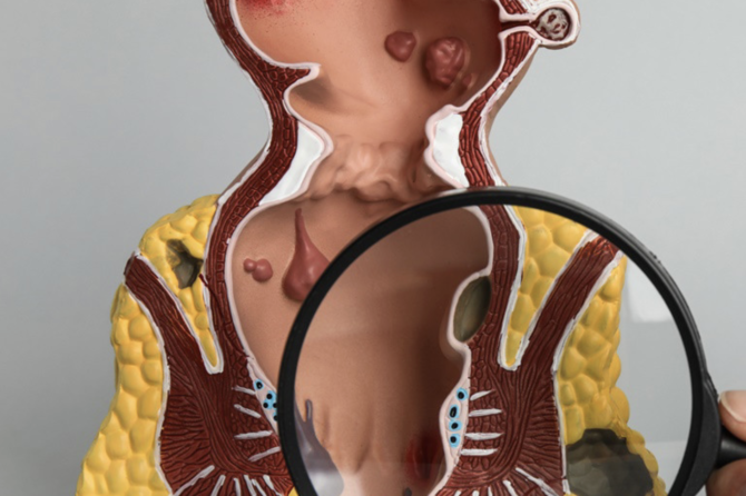 Anal Çatın 5 Əlaməti və Edilməsi Gərəkənlər