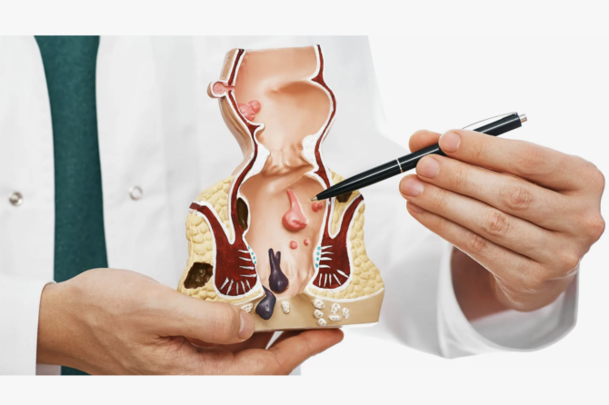 Hamiləlikdə Makat Problemləri Necə İdarə Olunmalıdır