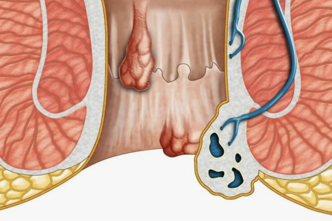 Türkiyədə Makat Estetikası Qiyməti Nə Qədərdir?