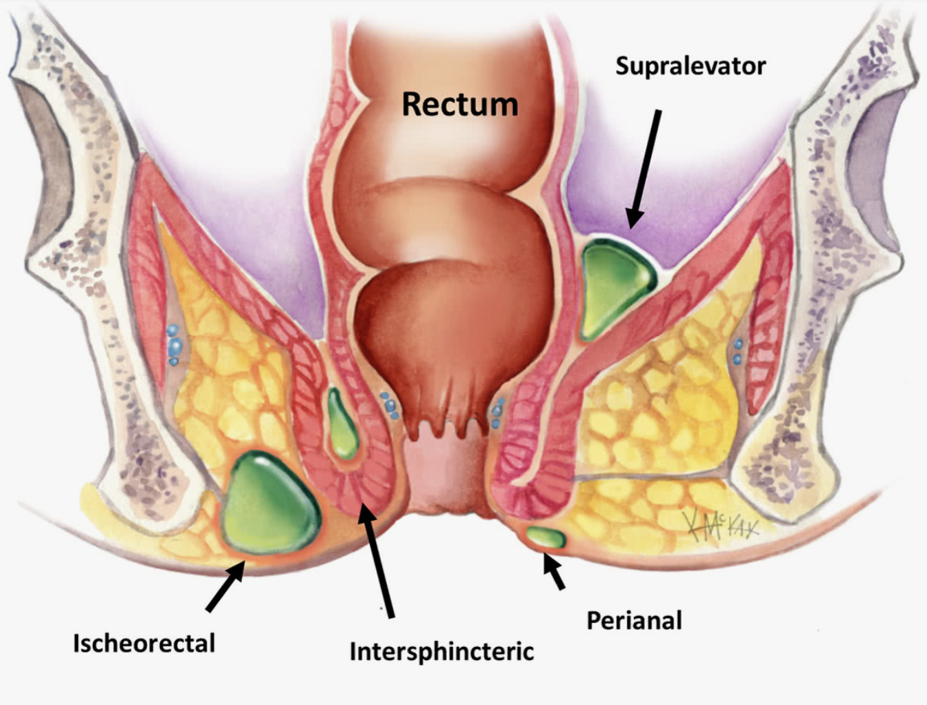Porno filmlarda ayol tanasini organish Xotin jinsiy xotini: munosabatlarning ijobiy va salbiy tomonlari