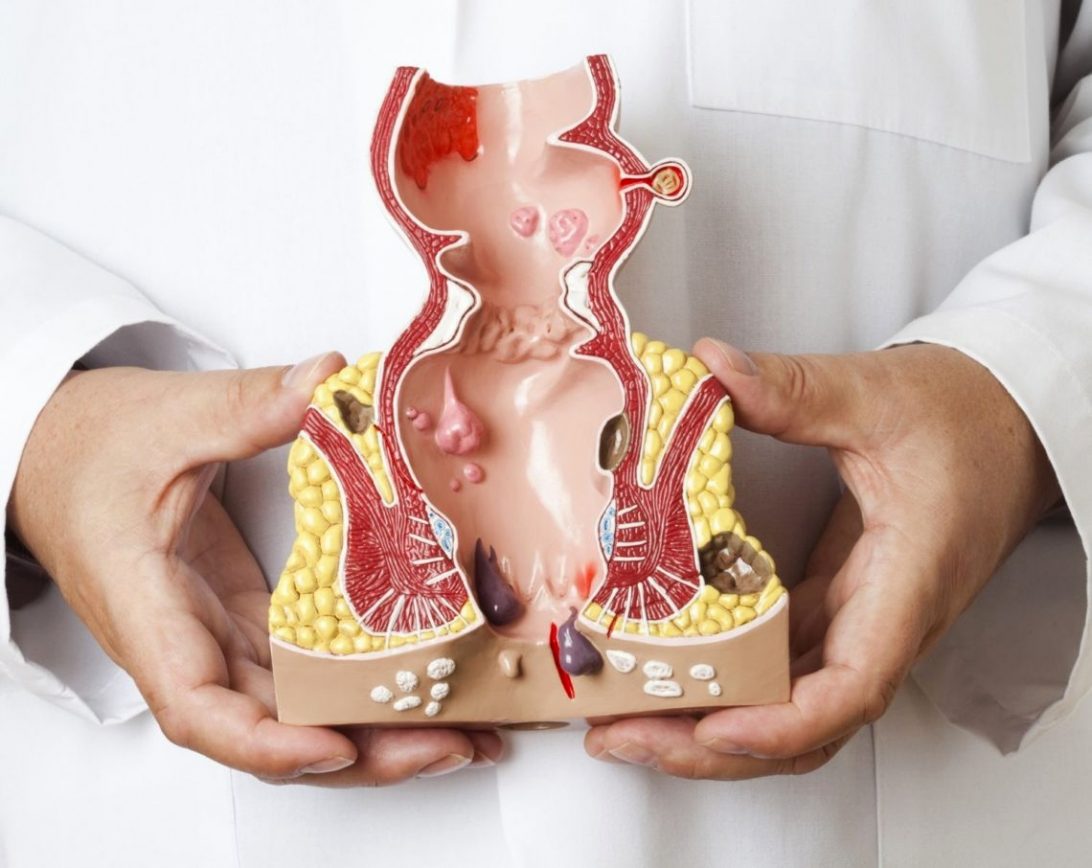 Itching in the anal area