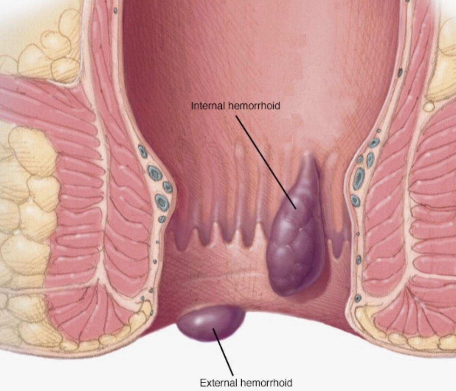 Medical Illustration