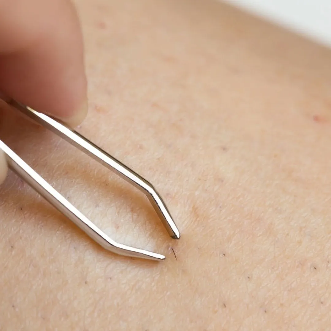 kil-donmesi-nedir-kil-donmesi-belirtileri-nelerdir