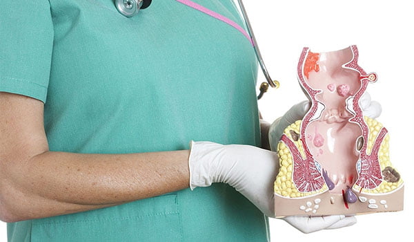 Traitement non chirurgical de la fissure anal