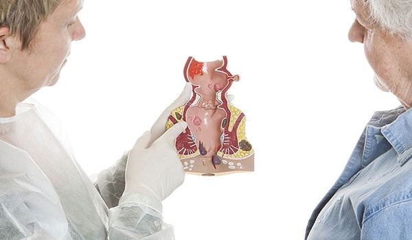 Traitement non chirurgical de la fistule anal