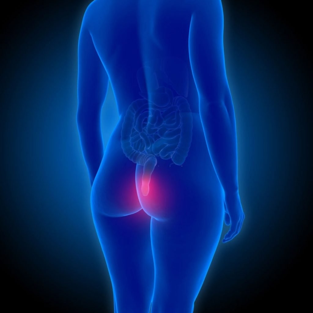 Traitement de la fissure anal sans chirurgie