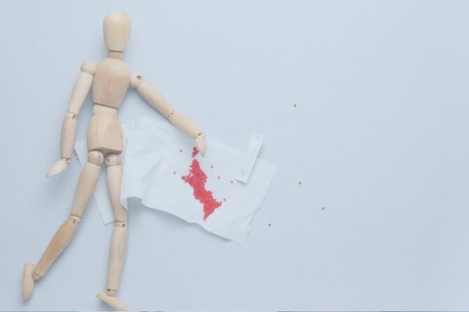 Comment le traitement de la fistule anale est-il effectué au laser ? Quels en sont les avantages ?