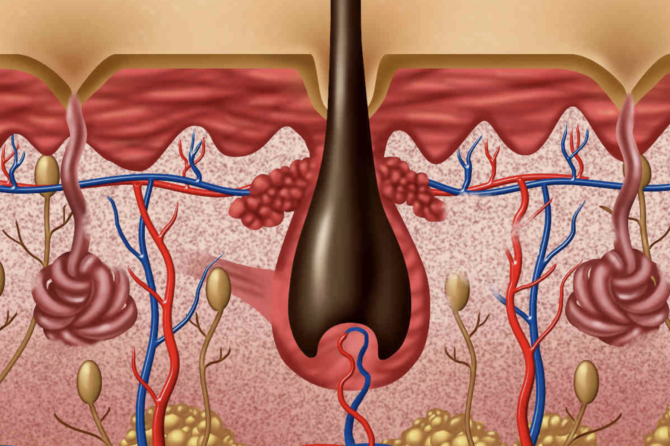 Qu’est-ce qu’un poil incarné inflammé ?