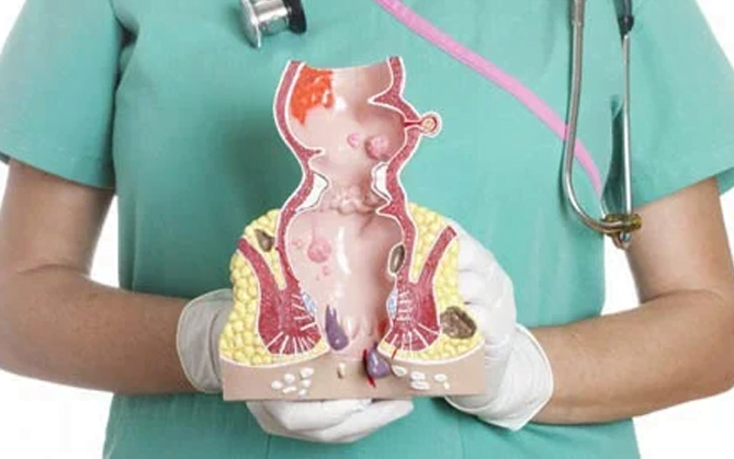 Kako Da Znate Da Li Imate Analnu Fisuru