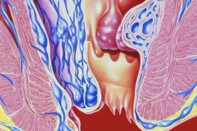 Na Koje Bolesti Ukazuje Iscedak I Neprijatan Miris İz Anusa?