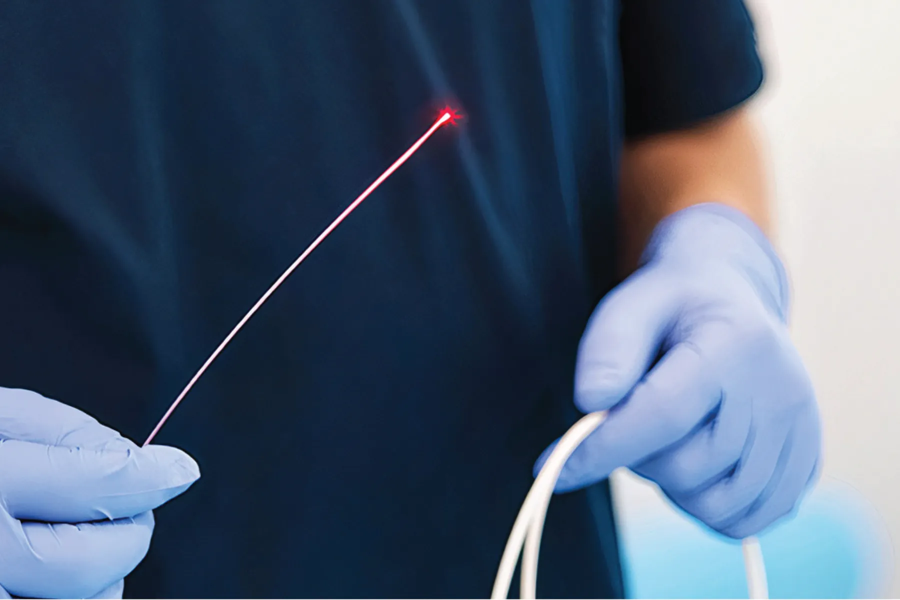 Laser treatment of hidradenitis suppurativa