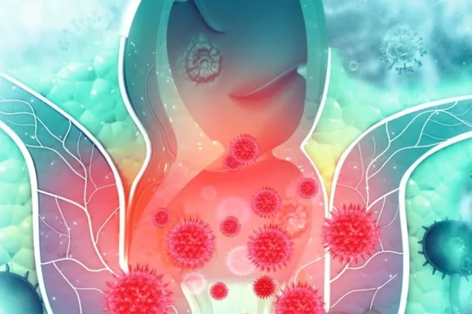 Na Koje Bolesti Ukazuje Iscedak I Neprijatan Miris Iz Anusa?