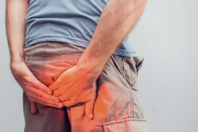 Šta Uraditi Kada Se Pojavi Analna Fistula