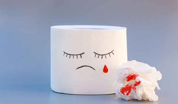 Как проводится безоперационное лечение анальных трещин?