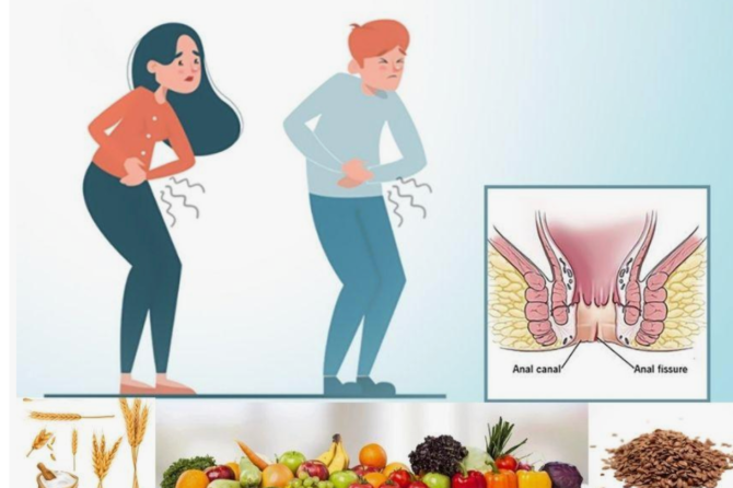 Как должен питаться пациент с анальной трещиной